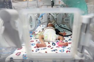 Taxa de nascimentos prematuros do Brasil está acima da média global